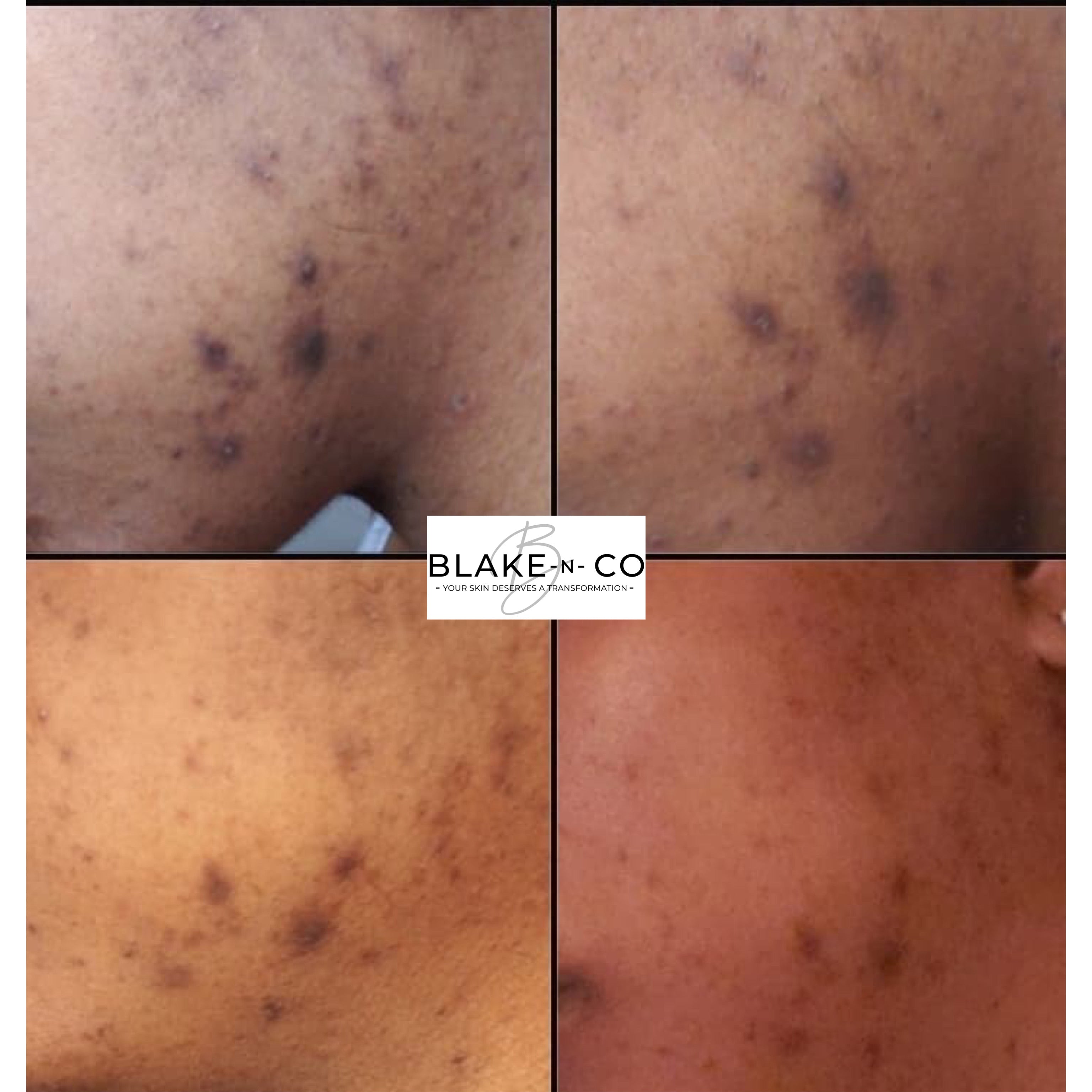 Honey Papaya Face Kit
