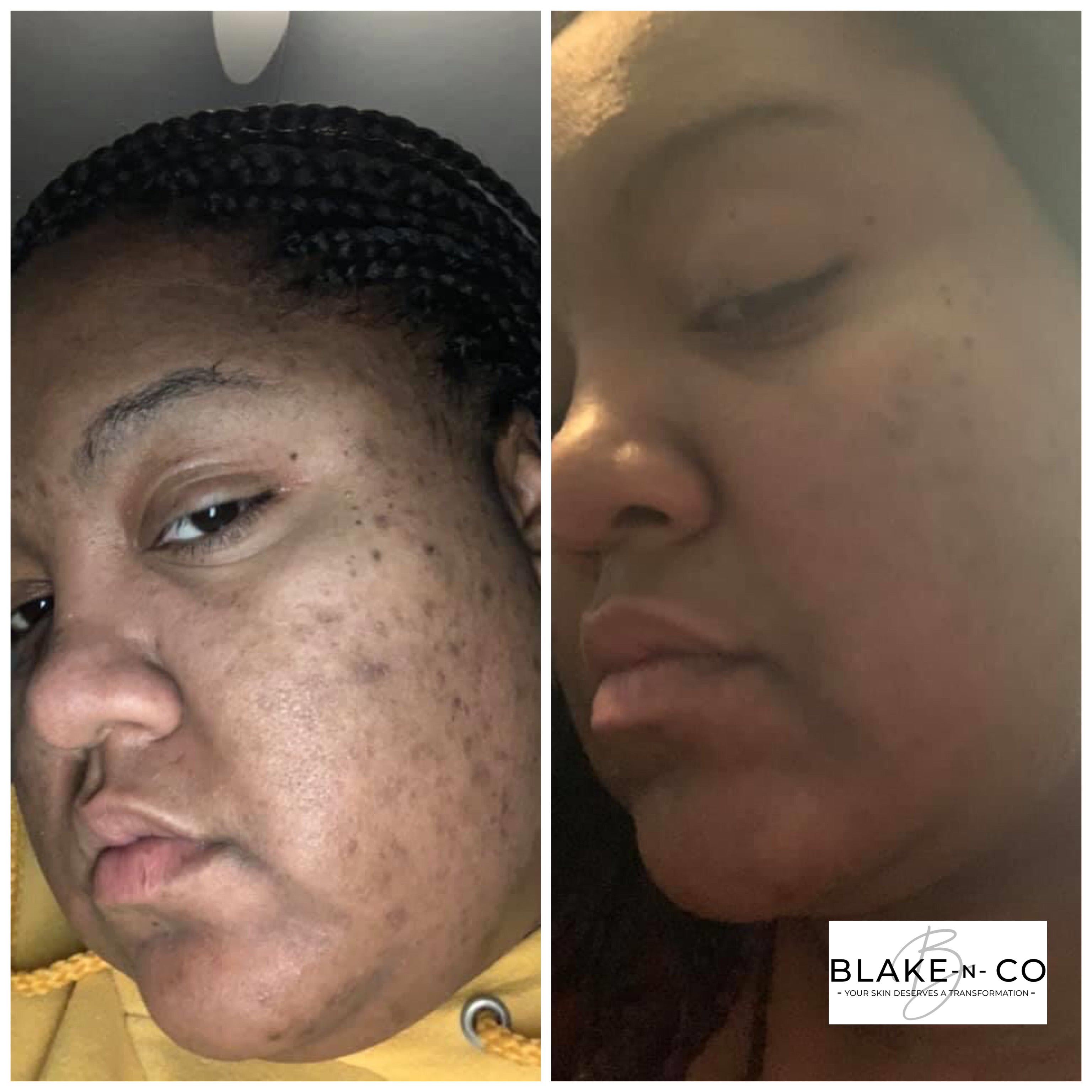 Honey Papaya Face Kit