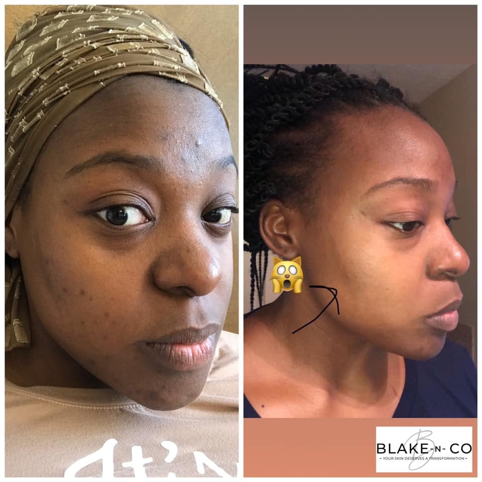 Honey Papaya Face Kit