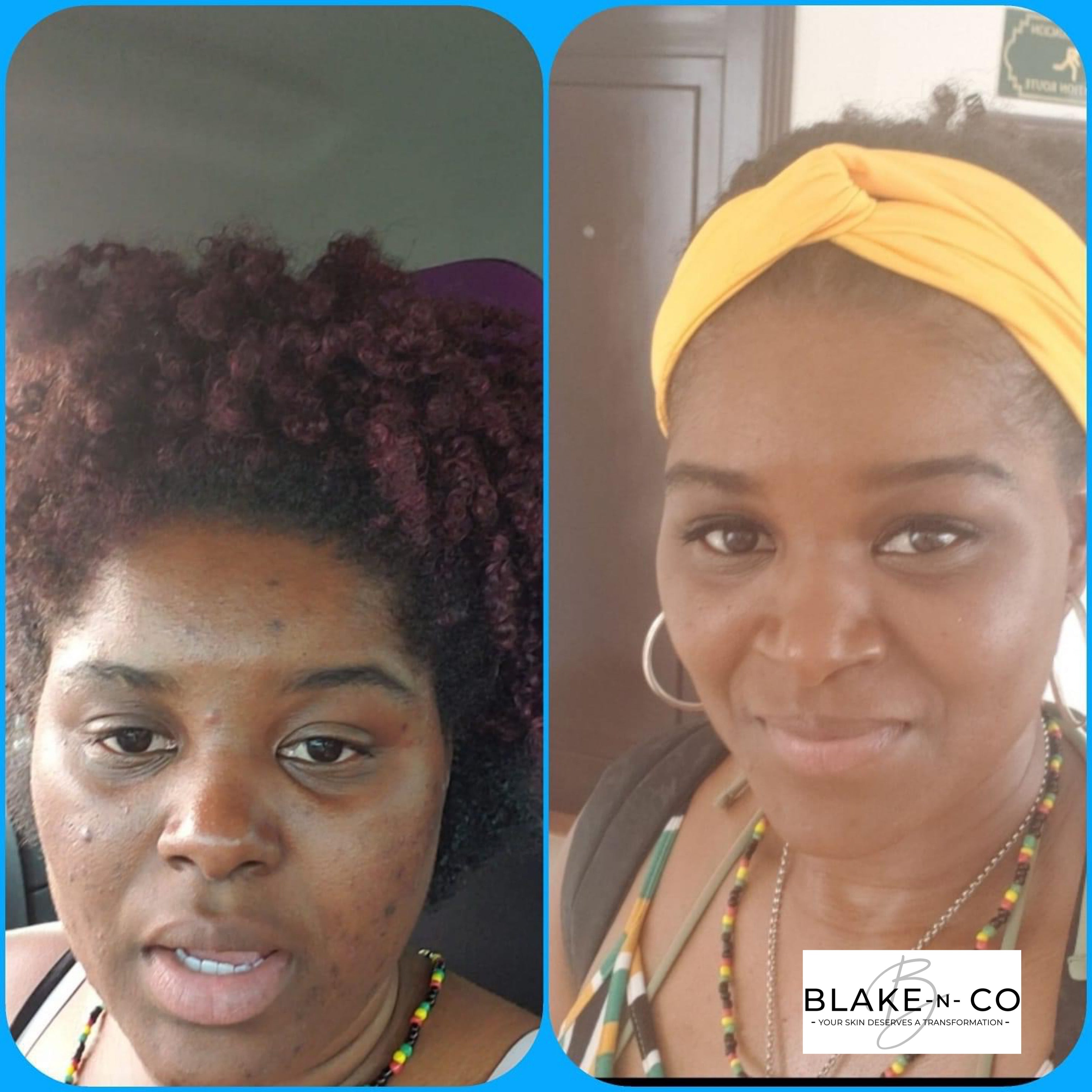 Honey Papaya Face Kit