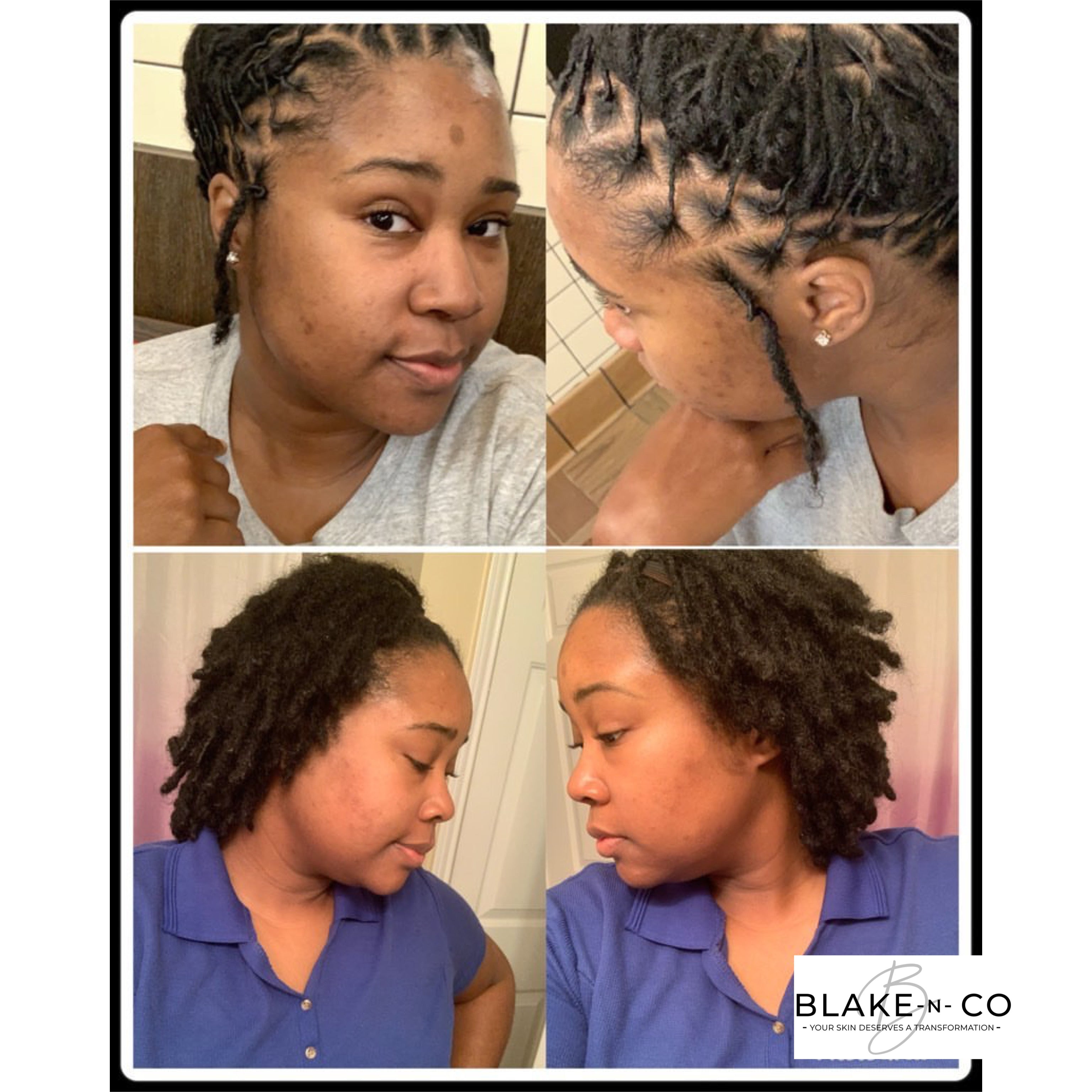 Honey Papaya Face Kit